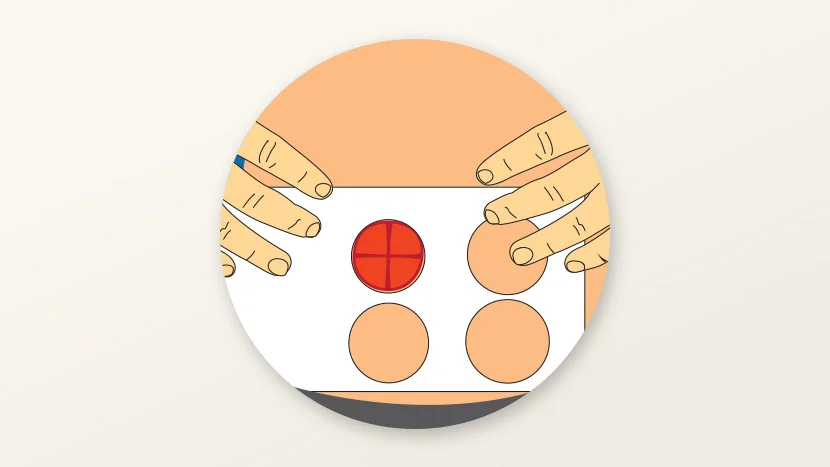 Illustration af, hvordan man måler en stomi